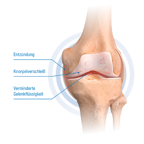 Knie Animation ACP