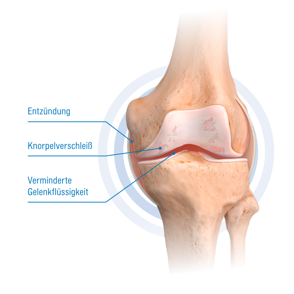 Knie Animation ACP